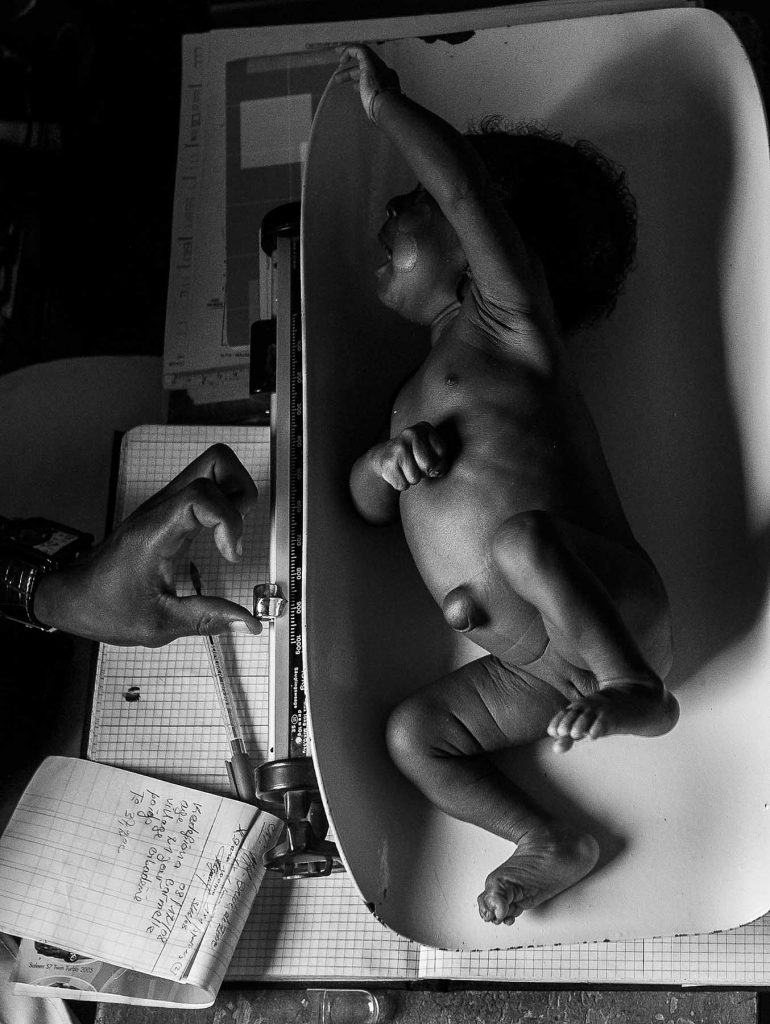 sleeping-sickness-weighing